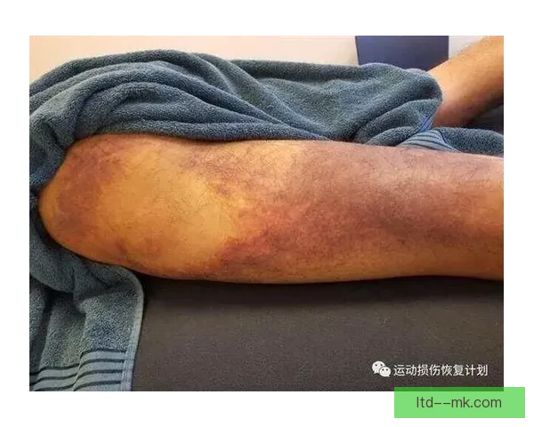 加亚频繁遭遇肌肉拉伤困扰如何影响他的职业生涯与恢复计划